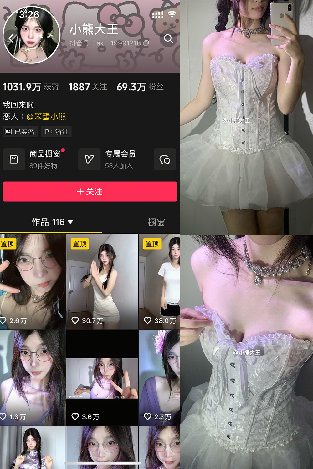 抖音 小熊大王 微密圈 001期 【32P】-吃口软饭