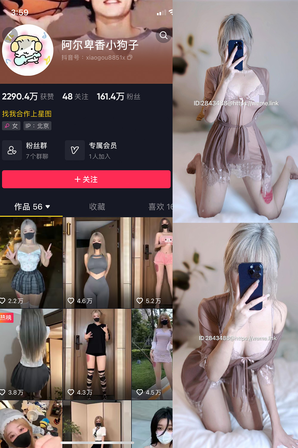 抖音 阿尔卑香小狗子 微密圈  NO.045期 【39P】最新至：2026.6.9-吃口软饭